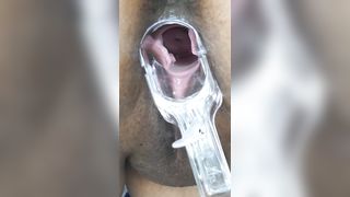 Plug En Mi Culo y Especulo