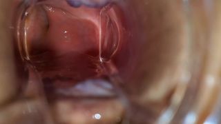 BBW Extreme Anal and Asshole Speculum Gape - 1 image