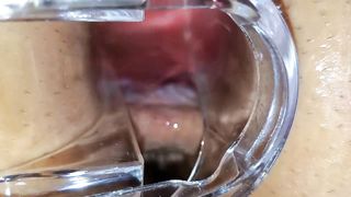 BBW Extreme Anal and Asshole Speculum Gape - 11 image