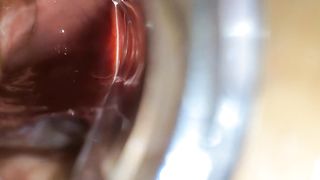 BBW Extreme Anal and Asshole Speculum Gape - 12 image