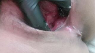 After Getting Rammed and Brutally Fucked by a BBC - 1 image