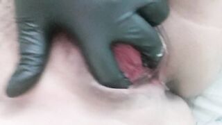 After Getting Rammed and Brutally Fucked by a BBC - 7 image