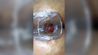 Kendall 9 masturbates her tight anus with a speculum