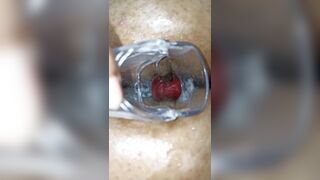 Kendall 9 masturbates her tight anus with a speculum