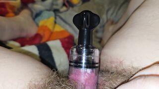 Clit Pumping And Orgasm For Fat Hairy Cunt