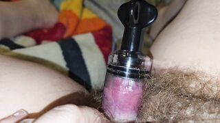 Clit Pumping And Orgasm For Fat Hairy Cunt - 5 image
